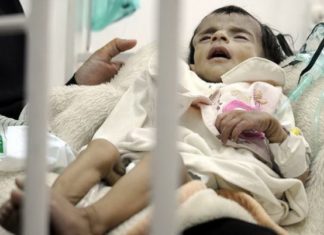Во Јемен секоја вечер 7 милиони дечиња во кревет заминуваат со празни стомачиња