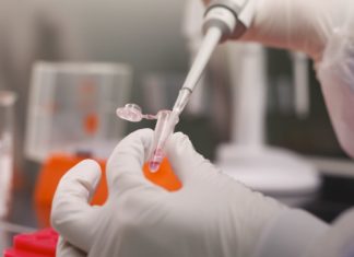 Шпанија прогласи вонредна состојба поради коронавирусот