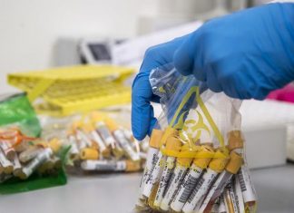 НОВА истражува: Се наплаќаат ли преку ФЗО тестовите за КОВИД-19 добиени преку донации