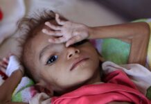 ОН: Годинава од глад во светот умреле седум милиони лица