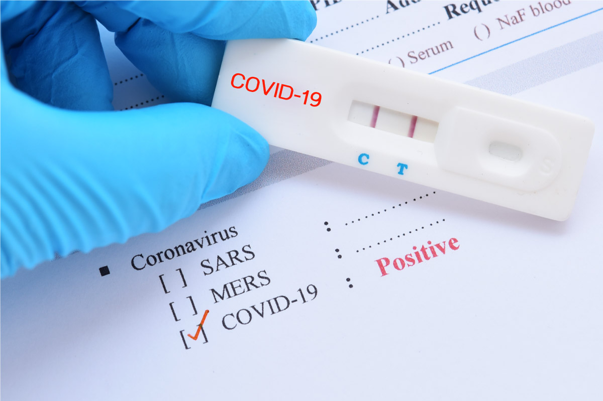 covid-19-test